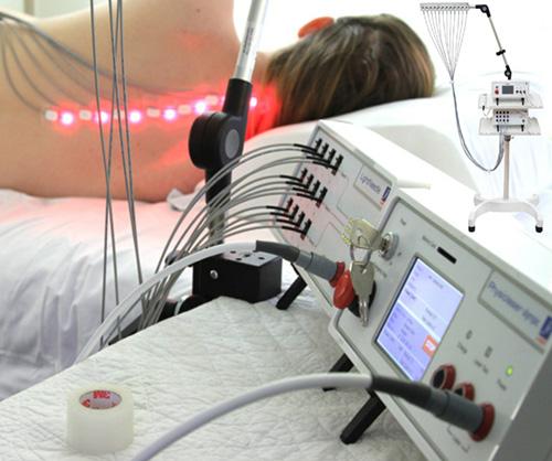LightNeedle (laser needle)