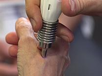 LaserPen acupuncture LaserPen acupuncture
