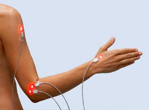 Lightneedle acupuncture